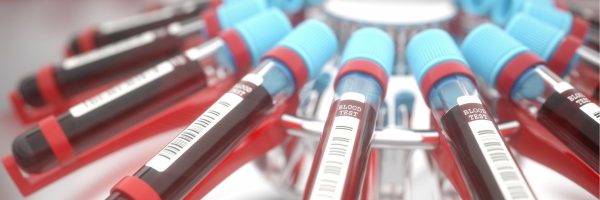 Rotalink | Centrifuge Lock Mechanism 4